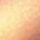 rotgold